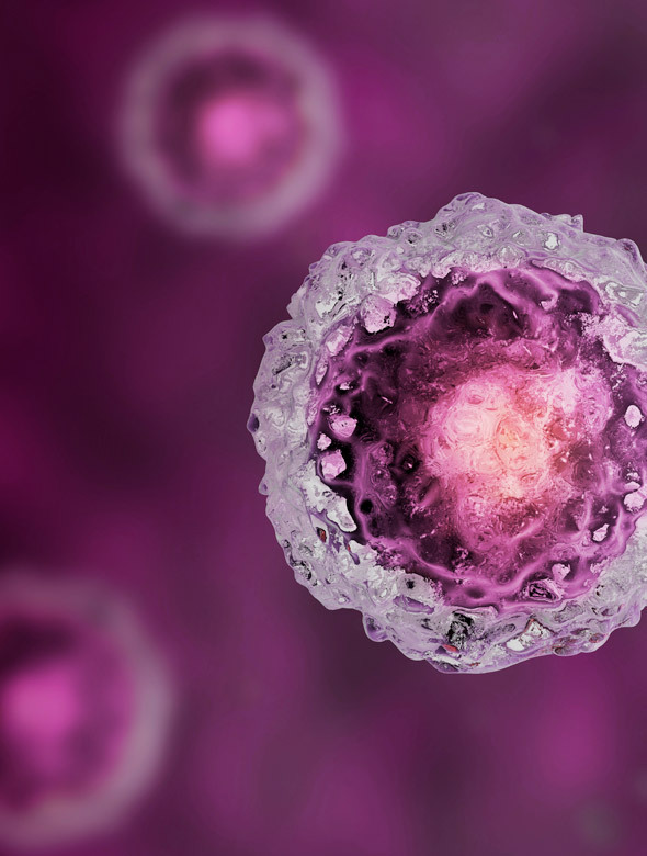 Jazz Pharma ES Quotes